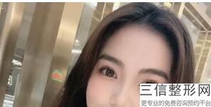 南充割双眼皮医院哪家好,2022南充光博士整形医院排名靠前