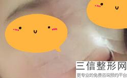 南充隆鼻好的医院排名榜前六强名单发布,2022南充韩美整形医院位列前十