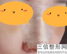 南京鼻王是谁,2022金志昱(从业23年)排名靠前