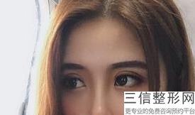 南京割双眼皮比较出名的医院排名,2022南京艺星医疗美容门诊部不容错过