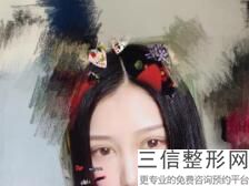 南京鼓楼医院整形科价格表,2022去眼袋做手术口碑良好