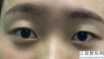 南京好的眼科医院排名前十名版,2022江苏省人民医院眼科锁定前十