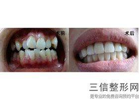南京口腔连锁机构排名前三权威盘点,2022南京牙管家口腔门诊部实力入围