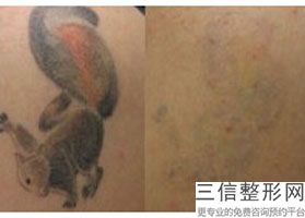 南京拉皮手术哪个医生做的好,2022孙国鼎医生首次上榜