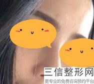 南京隆鼻医生排行前三名单揭晓,2022沈正宇实力上榜