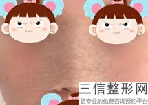 南京隆鼻医生排行前十技术在线比拼,2022赵联阁实力入围