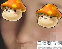 南京隆鼻医生排名前十点名啦,2022娄霞口碑不错