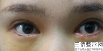 杭州双眼皮哪家做的好,2022杭州格莱美医疗美容医院首次上榜