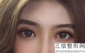 杭州双眼皮哪家做的好,2022杭州双眼皮整形医院排行榜不容错过