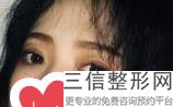 杭州双眼皮哪家做的好,2022杭州双眼皮整形医院排行榜不容错过
