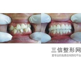 杭州私立口腔医院排名前十权威盘点,2022杭州格莱美口腔医院首次上榜