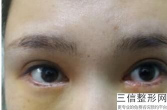 杭州眼部手术整形医院排行前十强,2022杭州整形医院位列前十