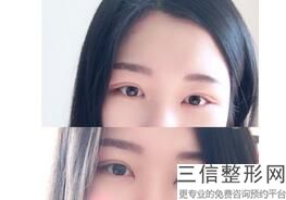 杭州眼睛近视手术医院排名,2022杭州眼睛近视手术医院排名实力非凡