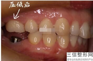杭州整牙医院排名榜top8,2022杭州省口腔医院实力超强