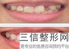 杭州种植牙技术好的医生排行榜,2022杨帆医生锁定前十