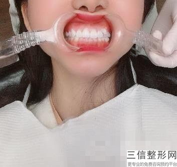 杭州种植牙医院排名榜前十,2022杭州雅乐口腔门诊部位列前十