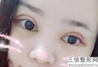 杭州做双眼皮的正规医院排名榜公示,2022杭州格莱美医疗美容医院首次上榜