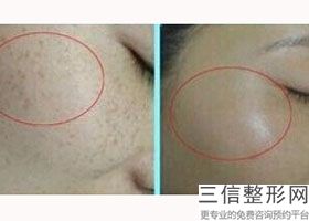 合肥皮肤科医院哪个好一点,2022合肥壹加壹医疗美容医院位列前十