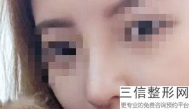 合肥做鼻子好的整形医院有哪些,2022合肥艺星整形医院口碑不错