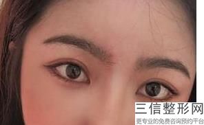 杭州双眼皮整形医院排名前五,2022杭州维多利亚医疗美容医院排名靠前
