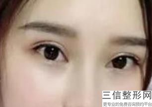 杭州眼修复整形医生排行榜,2022范眉清实力上榜