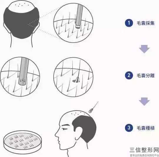 杭州良好的整形医院的排行榜,2022杭州首瑞植发医院口碑不错