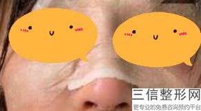 杭州做鼻子的医院哪个好,2022杭州格莱美整形美容医院排名靠前