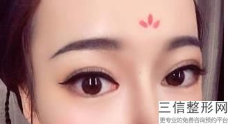 杭州做近视手术哪家医院好,2022杭州浙一医院眼科口碑良好