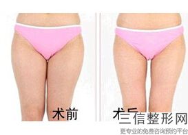合肥丰胸整形医院排行榜,2022合肥伊美辰医疗美容门诊部实力入围