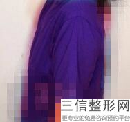 合肥隆胸整形医院排行前十,2022安徽省立医院整形烧伤外科排名靠前