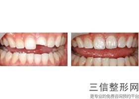 合肥牙齿矫正医院排名前十,2022合肥贝杰口腔医院实力超强