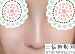 玻尿酸隆鼻的危害性有哪些，玻尿酸隆鼻好不好