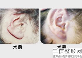 常州治耳朵哪家医院好，常州治疗耳石症哪里好
