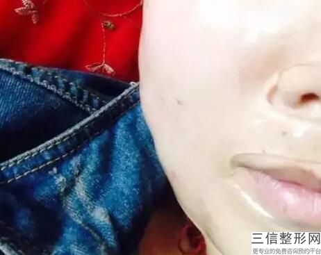 大连皮肤病医院激光脱毛，大连激光脱毛哪家医院好