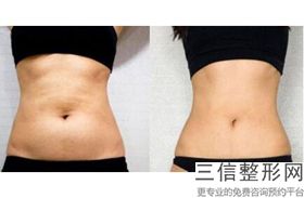 丰胸的方法有哪几种，丰胸方法5种