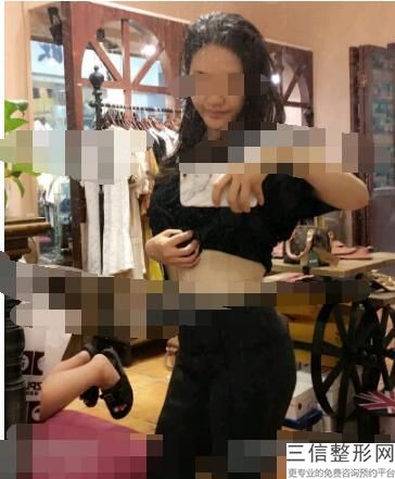 丰胸手术效果怎样,丰胸效果整形手术