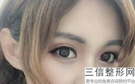 佛山割双眼皮一般都是多少钱，佛山割双眼皮哪里好_1