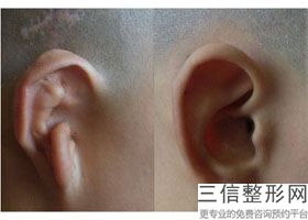 贵阳治疗耳鼻喉良好医院，贵阳哪家医院看耳朵好