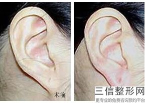贵阳治疗耳鼻喉良好医院，贵阳哪家医院看耳朵好