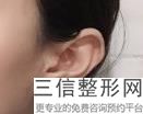 河南耳部整形哪家医院好,郑州治疗耳朵畸形哪家医院好