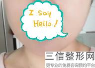 厚唇改薄唇珠肿了好几个月，厚唇改薄多久能消肿