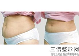 假体丰胸用的什么材料，丰胸假体有哪些