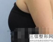 美容院胸部保养价格，胸部护理多少钱