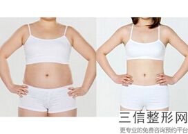 哪种丰胸方法效果好，比较有效果的丰胸方法