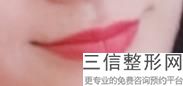 漂唇的方法与步骤,漂唇怎么漂