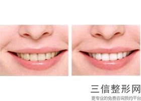 清华大学玉泉医院整形科怎么样，清华大学玉泉医院看牙怎么样