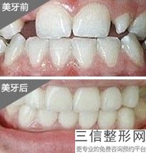 清华大学玉泉医院整形科怎么样，清华大学玉泉医院看牙怎么样