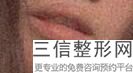 如何让嘴唇变薄变小，怎样把嘴唇变小变薄