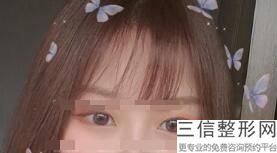 上睑下垂术后失败还可以修复吗，上眼睑下垂术后会复发吗
