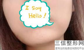 脱唇毛好吗-，冬天可以脱唇毛吗